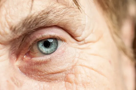 old eye conditions