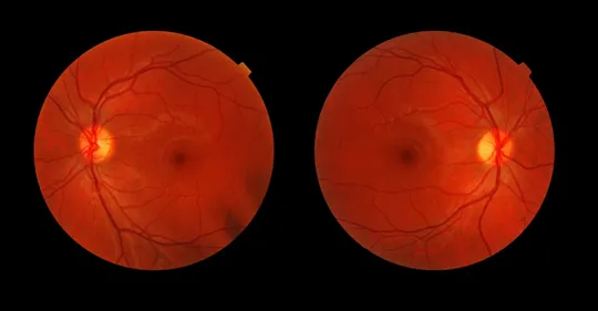 eye tests